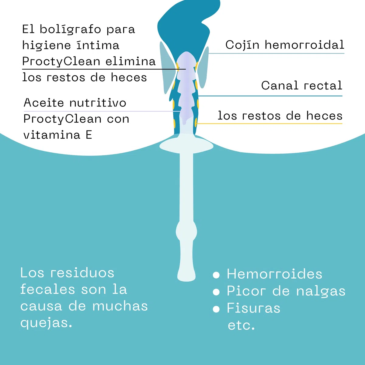 Bastoncillo de higiene íntima ProctyClean ¡Patentado! Higiene anal suave y cuidado íntimo para mujeres y hombres. Ayuda con hemorroides, fisura anal, picor y ardor en el ano. Mujeres, hombres.
