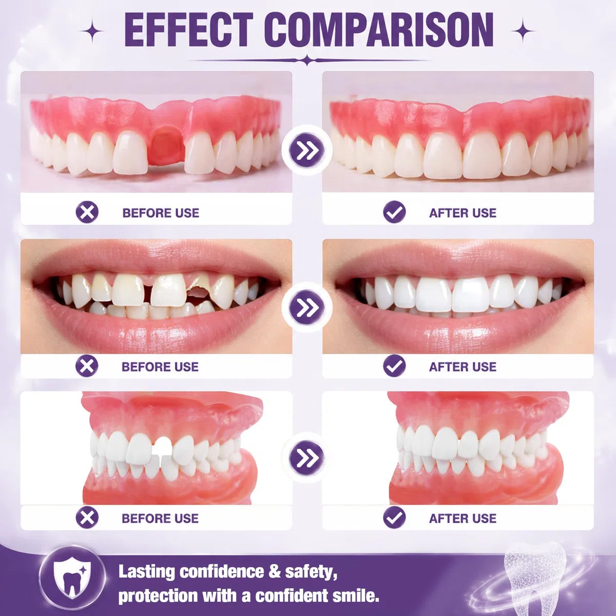 Cemento Dental Permanente, Cemento Dental, Pegamento Dental, Resistente Al Calor y Al Agua, Apto para Restauraciones Dentales, Incluyendo Coronas y Prótesis Dentales