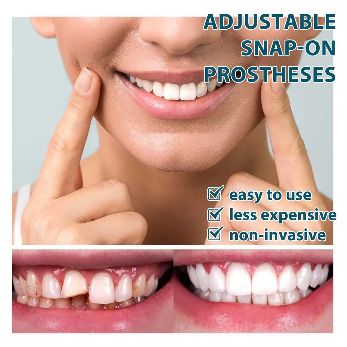 Prótesis Ajustables De Clipser,Clip-On Para Dientes Arriba Y Abajo,Prótesis Facetadas,Dentidos Sonrisa Falsa,Dentidos Temporales,Faceta Dental Cosmética