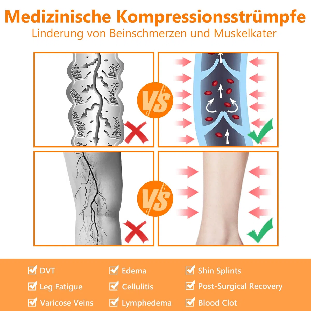 Medias de Compresión Médicas 20-30 mmHg Clase 2 | Hasta el Muslo, Sin Pie | Graduada con Banda de Silicona | Unisex para Mujeres y Hombres | para Varices, Edemas, Vuelos, Deporte y DVT