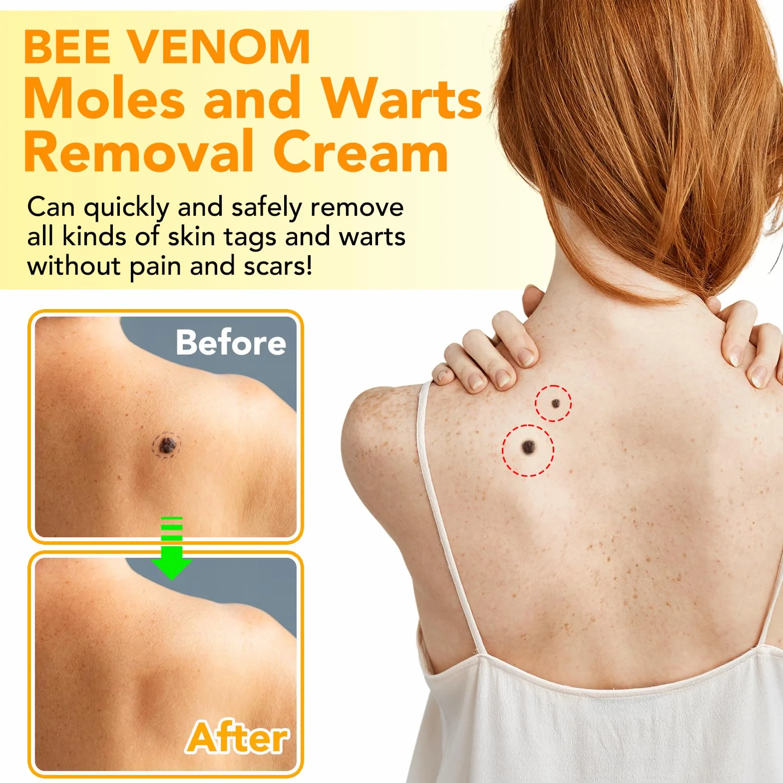 Crema Veneno De Abeja Verrugas, Crema Reparadora Veneno Abeja, Crema De Veneno De Abeja, Quitar Verrugas Antiverrugas Quita Verrugas Cuerpo Para Todo Tipo De Piel, 200g