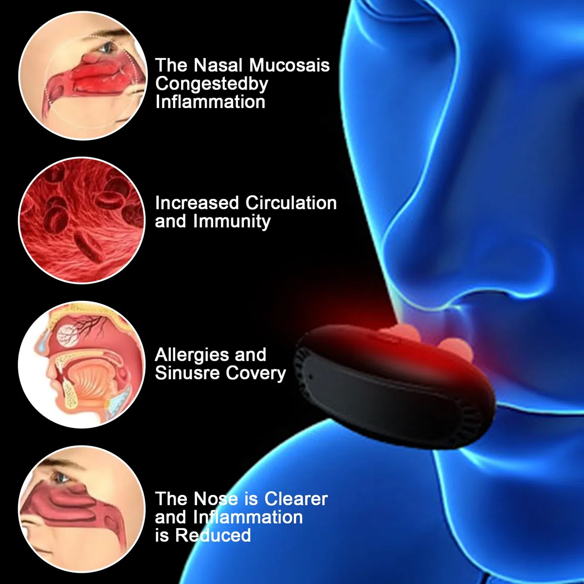 Dispositivo de Nariz con Luz Roja, Calmante Nasal de Fisioterapia, Herramienta para Aliviar La Rinitis, Luz Roja Portátil Instrumento de Terapia Nasal para Aliviar Los Síntomas de La Rinitis