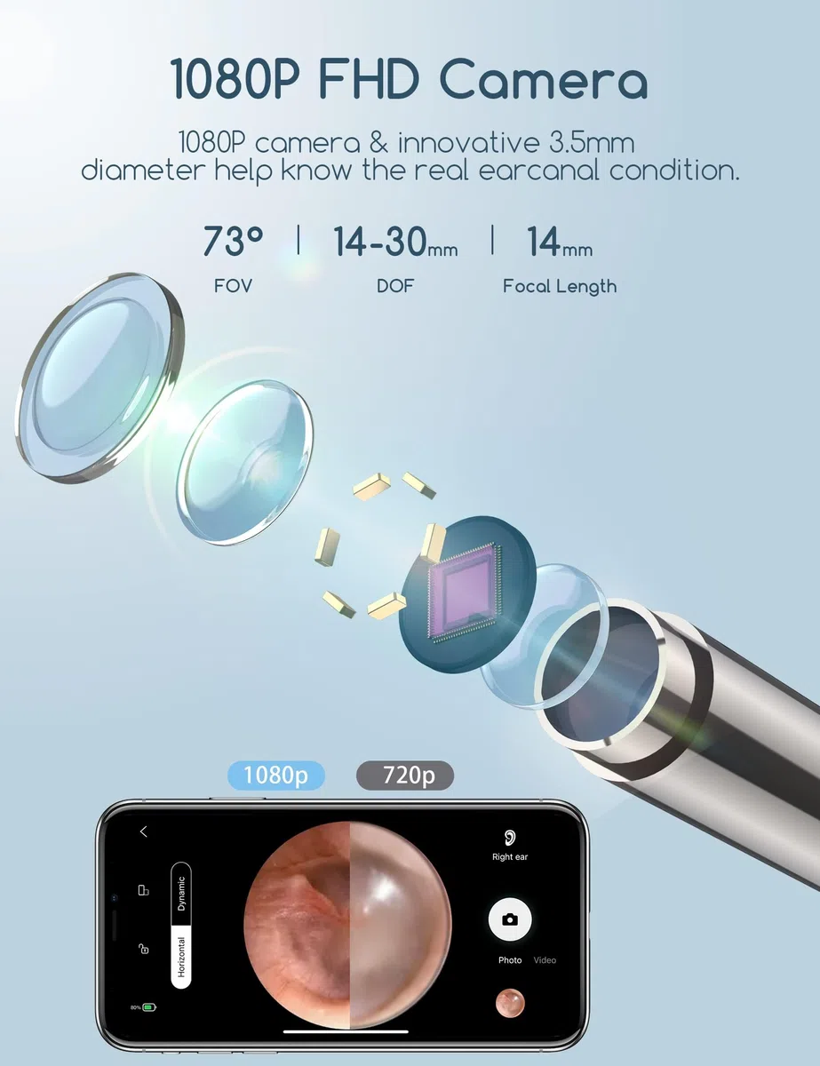 Qimic Otoscopio 3,5mm WiFi Endoscopio con 6 LED Camara Endoscopica Inalámbrico, Kit de Limpiador de Oídos para Eliminación de Cerumen para iPhone, Tabletas y Android