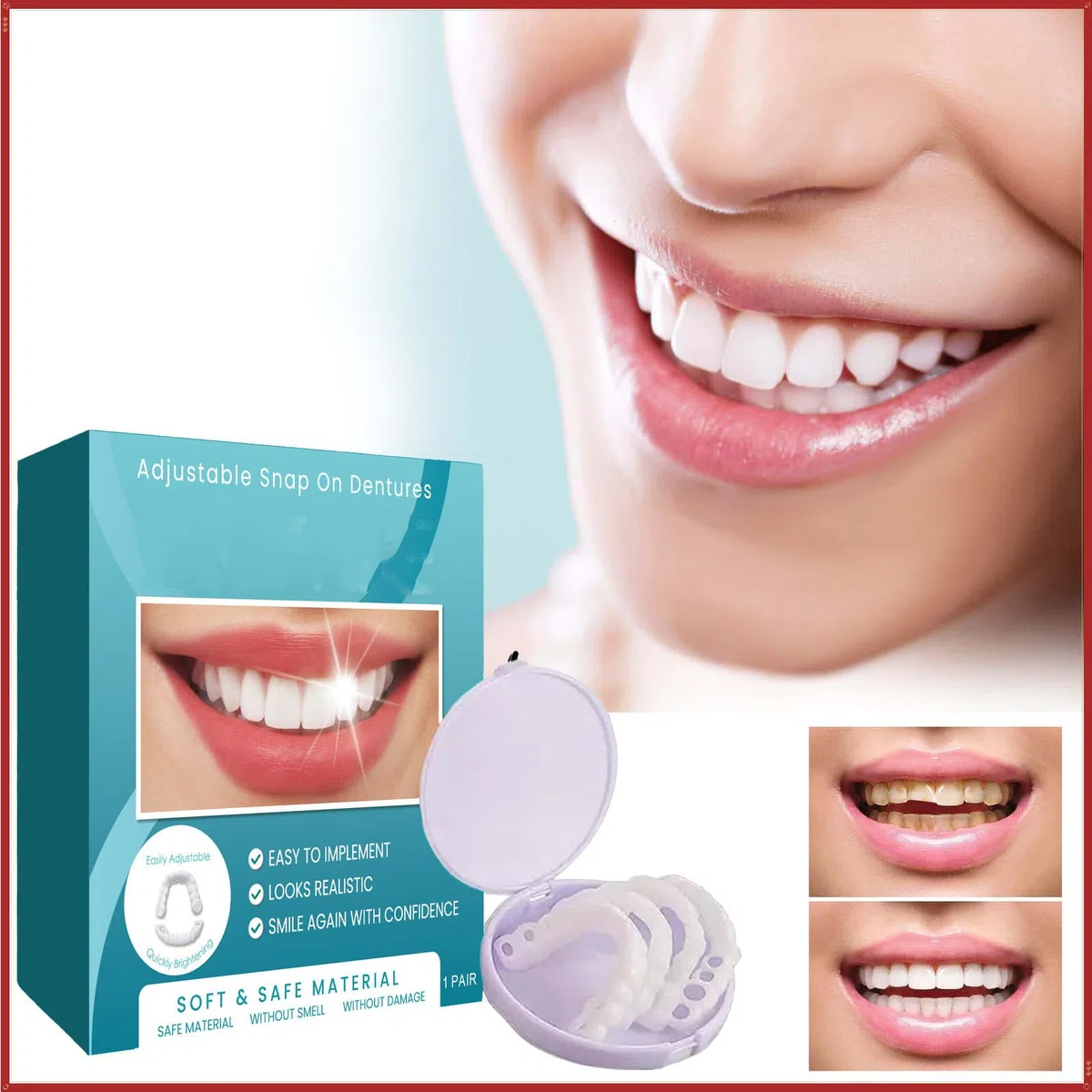 Prótesis Ajustables De Clipser,Clip-On Para Dientes Arriba Y Abajo,Prótesis Facetadas,Dentidos Sonrisa Falsa,Dentidos Temporales,Faceta Dental Cosmética