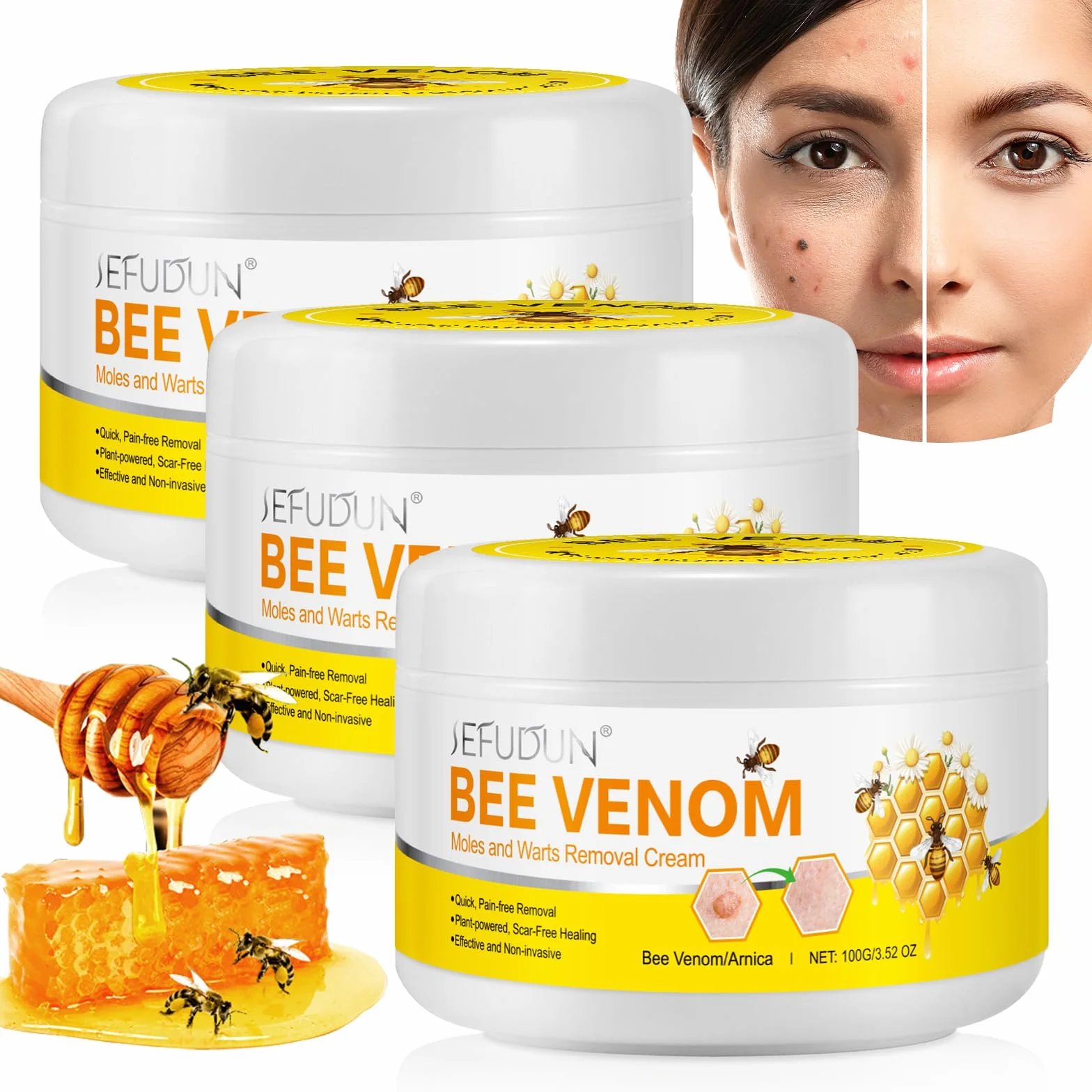 Crema Veneno De Abeja Verrugas, Crema Reparadora Veneno Abeja, Crema De Veneno De Abeja, Quitar Verrugas Antiverrugas Quita Verrugas Cuerpo Para Todo Tipo De Piel, 200g